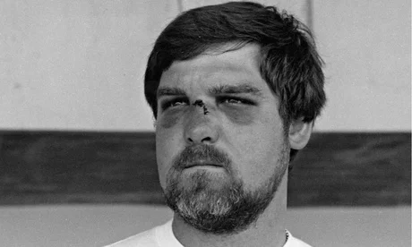 Mike Gatting injury on Nose